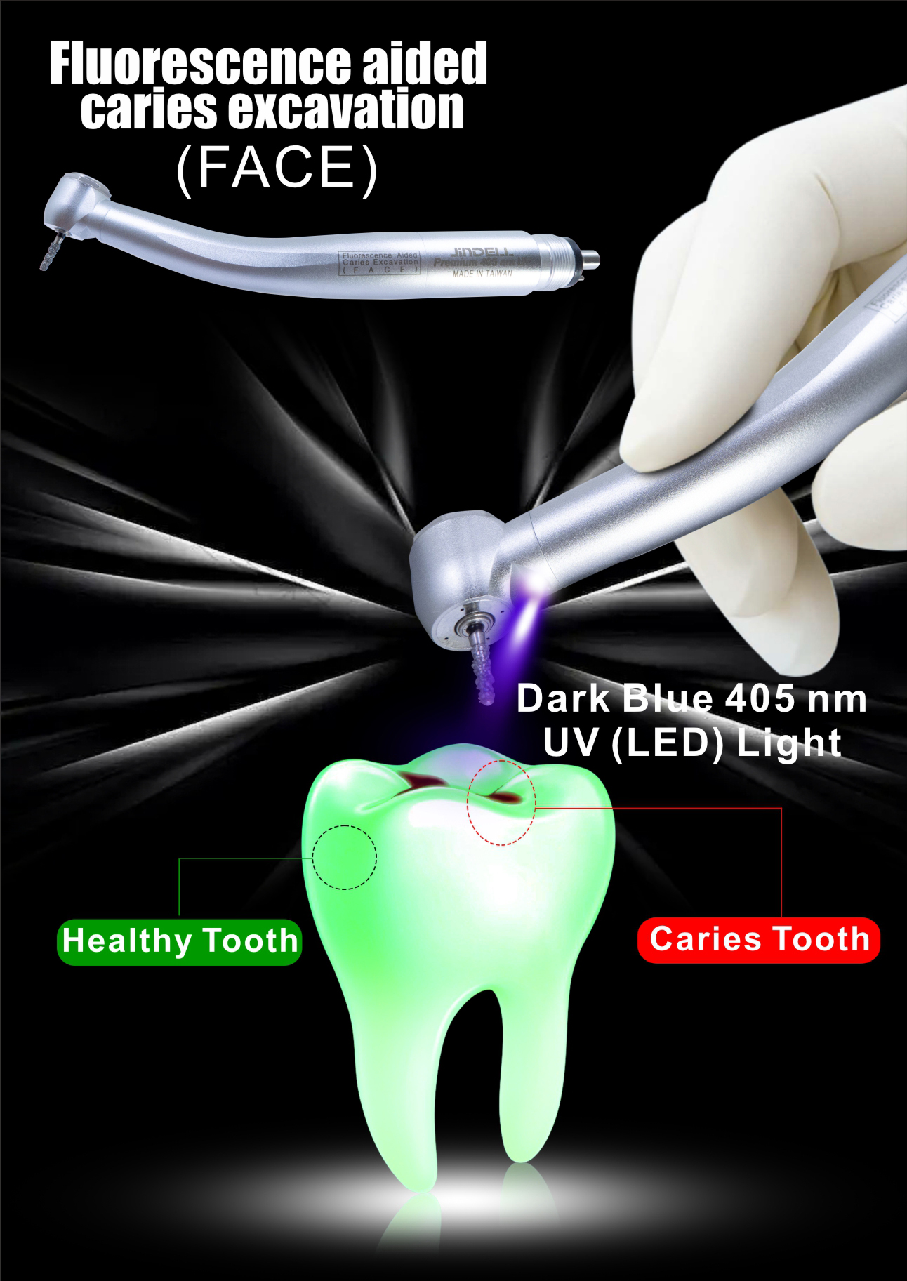 Fluorescence aided caries excavation (FACE) Turbines