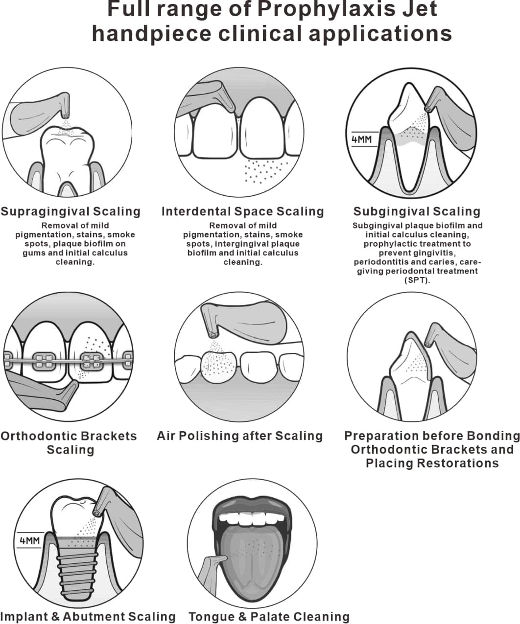 Full Range of Prophylaxis Jet handpiece Clinical applications