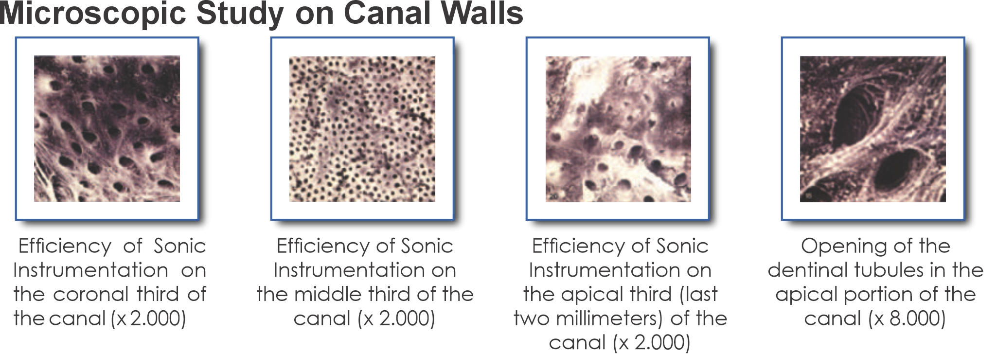 Sonic endodontic handpiece for efficient flaring, irrigation & cleansing; accepts SHAPERSONIC/Rispi Sonic files.